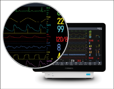 Comen innovamedica monitor multiparametro cuidados intensivos